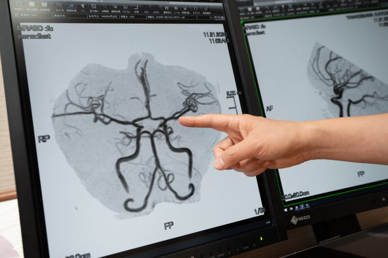 脳ドックの結果説明｜盛岡市のまさと脳神経内科クリニック